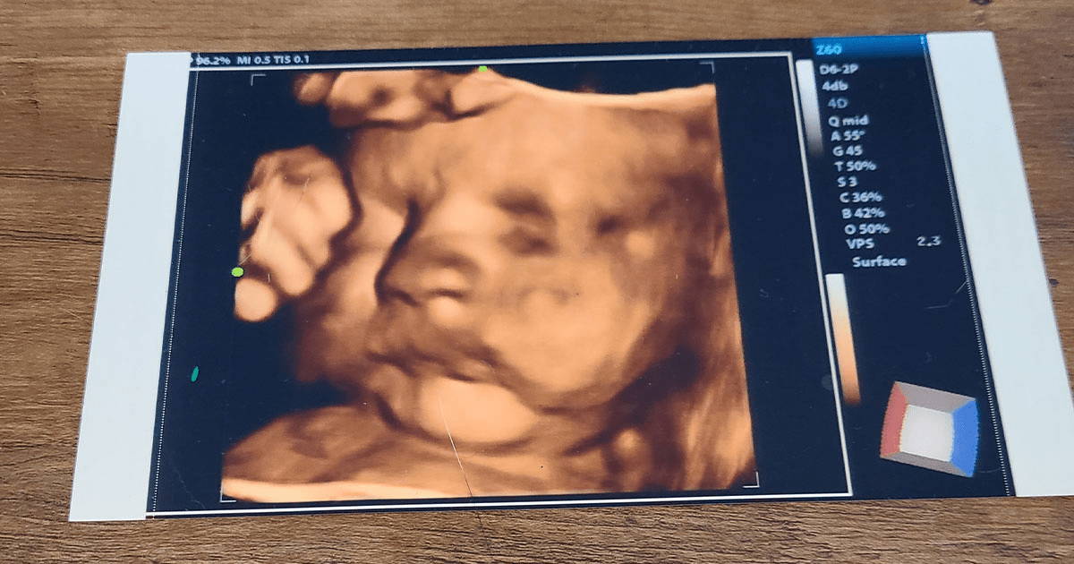 Keepsake Imaging 3D 4D Ultrasounds Offers Mobile In Home 4D Ultrasounds